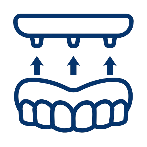Typen und Einsatzgebiete 