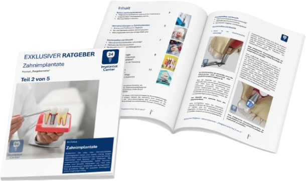 Zahnimplantate 2/5