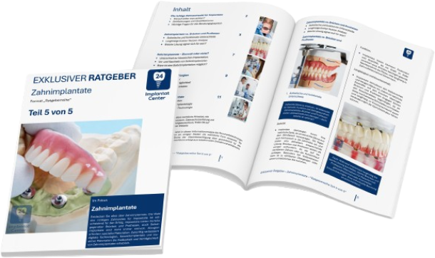 Zahnimplantate 5/5 