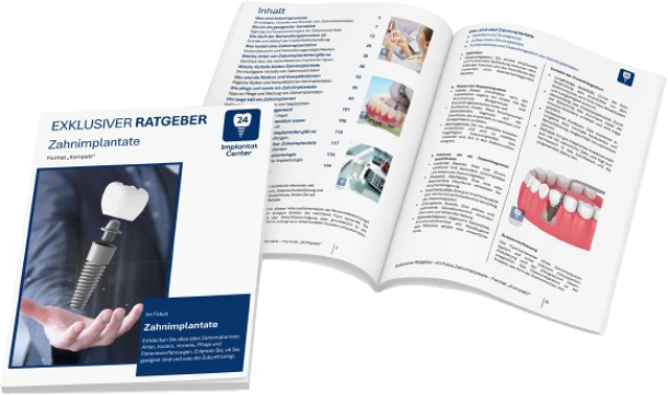 Zahnimplantate - Vollversion 