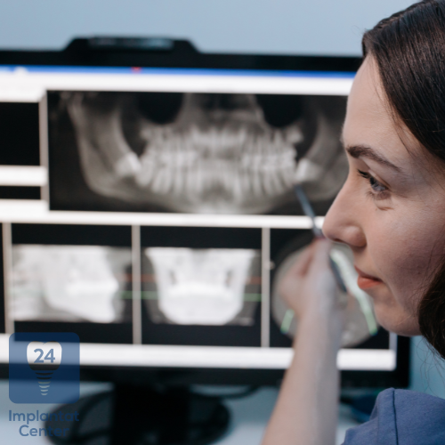 Voruntersuchungen und Diagnosen vor einer Zahnimplantation