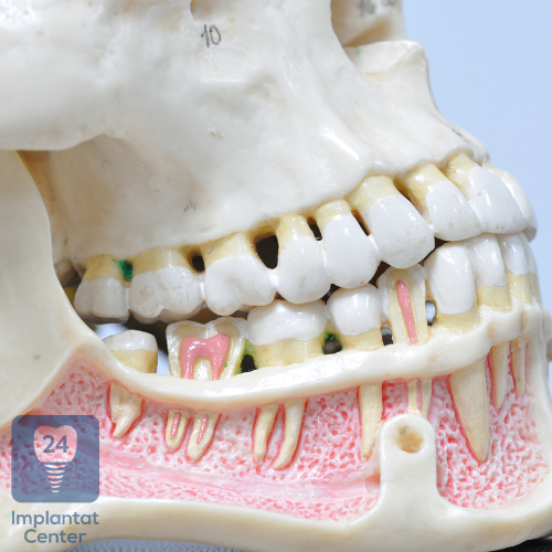 Langfristige Gesundheit des Kieferknochens