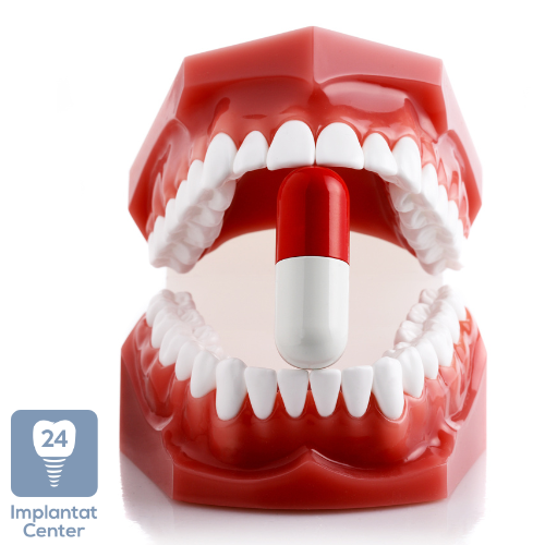 Erholungszeit und Schmerzmittel nach einer Zahnimplantation