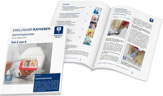 Zahnimplantate 2/5