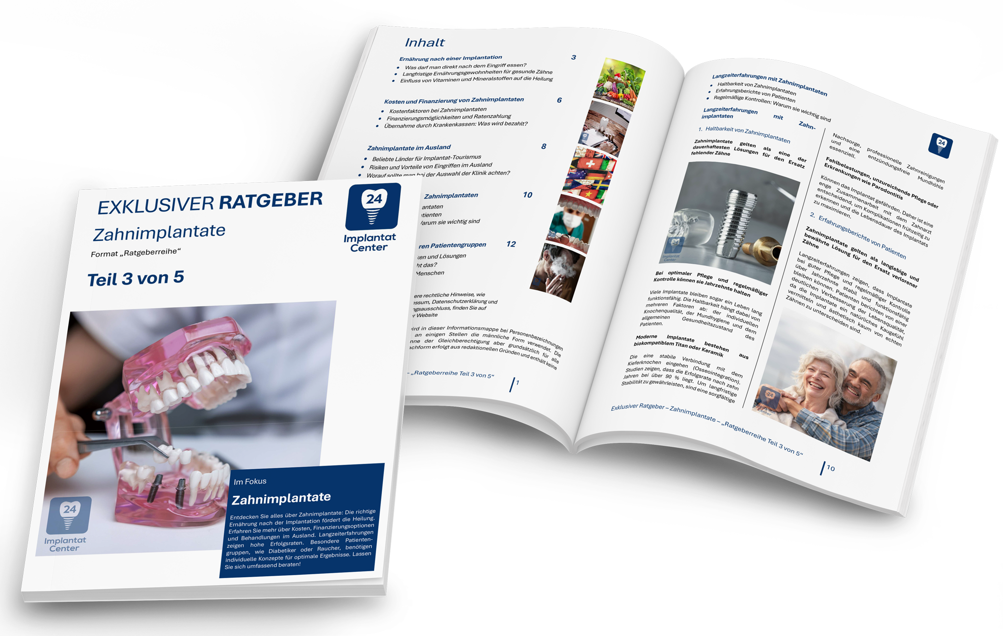 Buchcover und offene Seite eines Ratgebers zu Zahnimplantaten, mit einem Bild eines Zahnapparats und Text in Deutsch