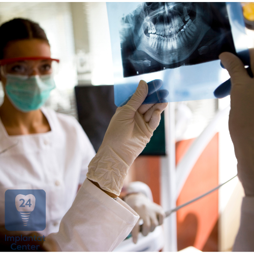 Arten von Zahnimplantaten