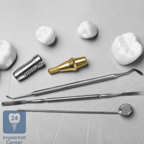 Abutmenteinsetzung ist ein wichtiger Schritt im Prozess der Implantation