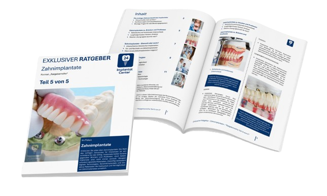 Zahnimplantate 5/5