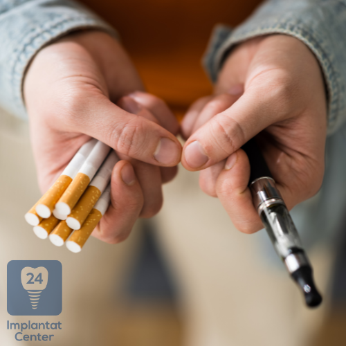 Einflussfaktoren der Lebensdauer eines Zahnimplantats