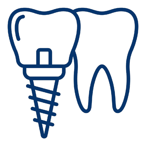 Illustration eines Zahns mit einem Implantat. Die linke Seite zeigt den Zahn mit einem Implantat, die rechte Seite einen natürlichen Zahn.