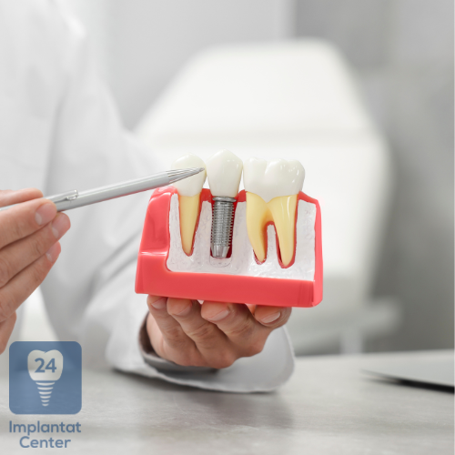 Risiken und Komplikationen