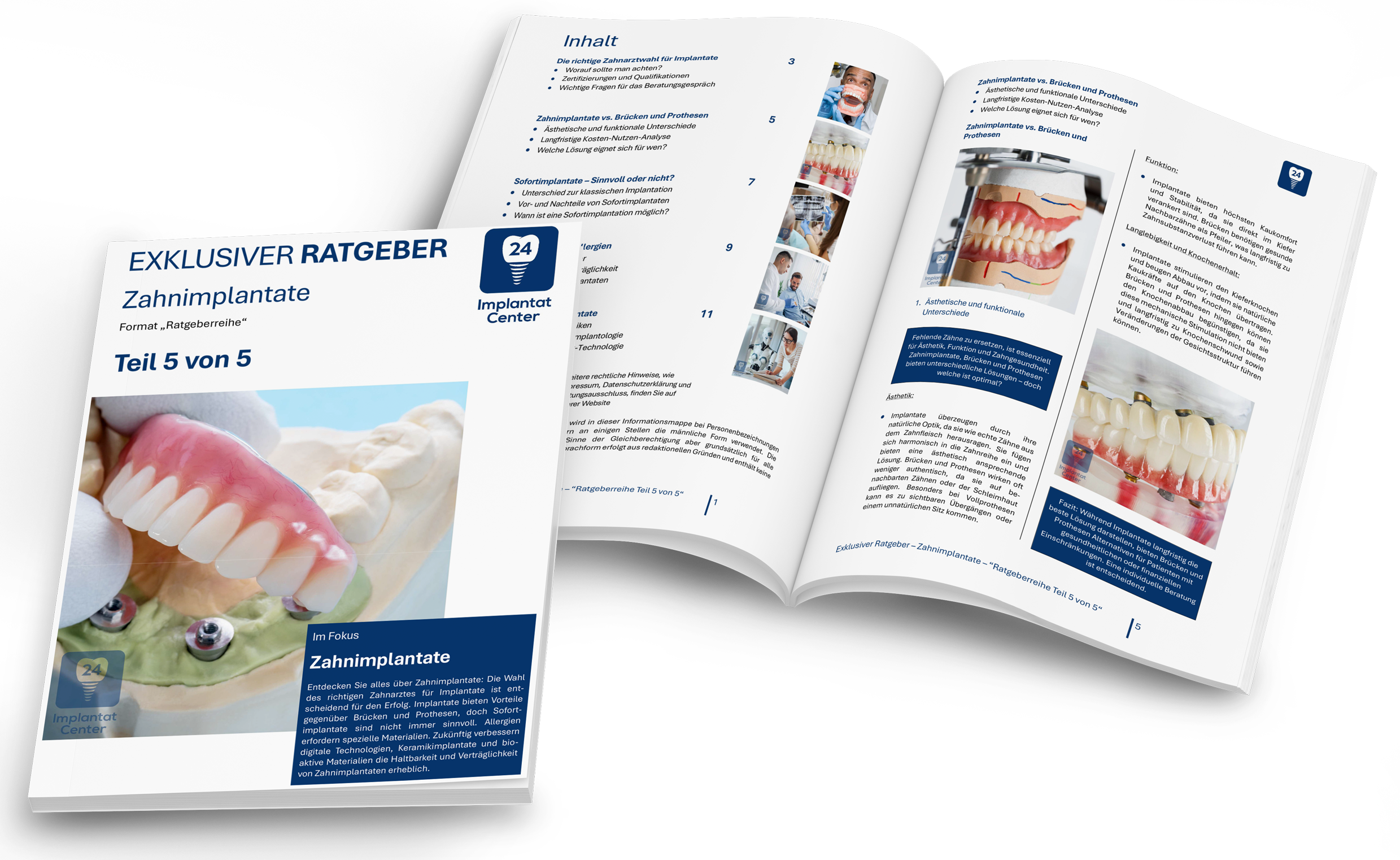 Offizieller Ratgeber über Zahnimplantate, Teil 5 von 5, mit einem Bild eines Zahnprothesensets. Das Heft zeigt eine detaillierte Übersicht über Zahnimplantate einschließlich Bildmaterial und Text.
