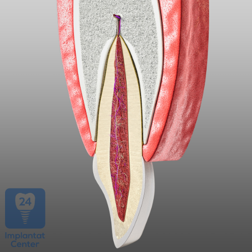 Regenerations-Techniken von Kiefer-Knochengewebe