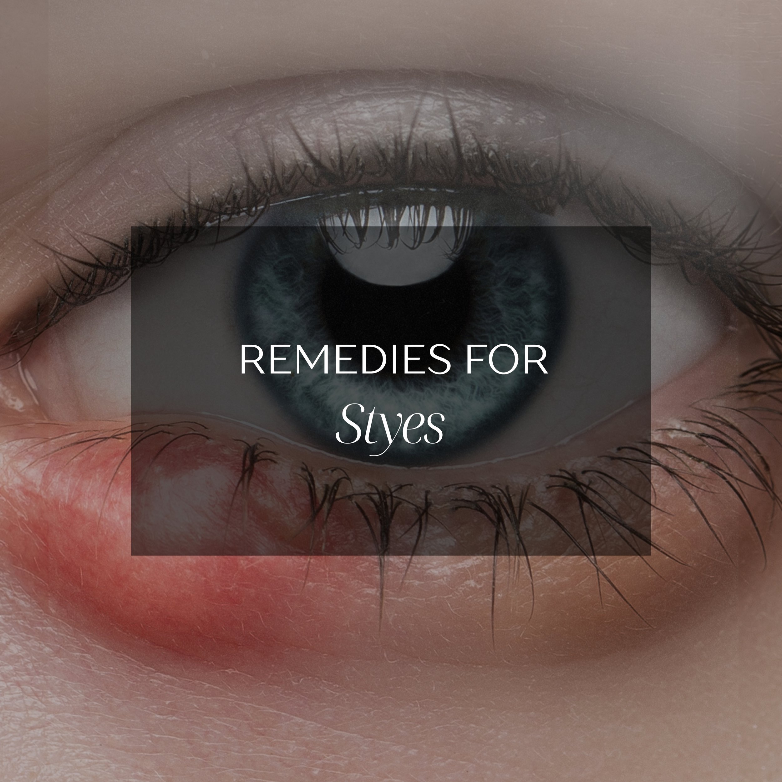 Homeopathic remedies for Styes