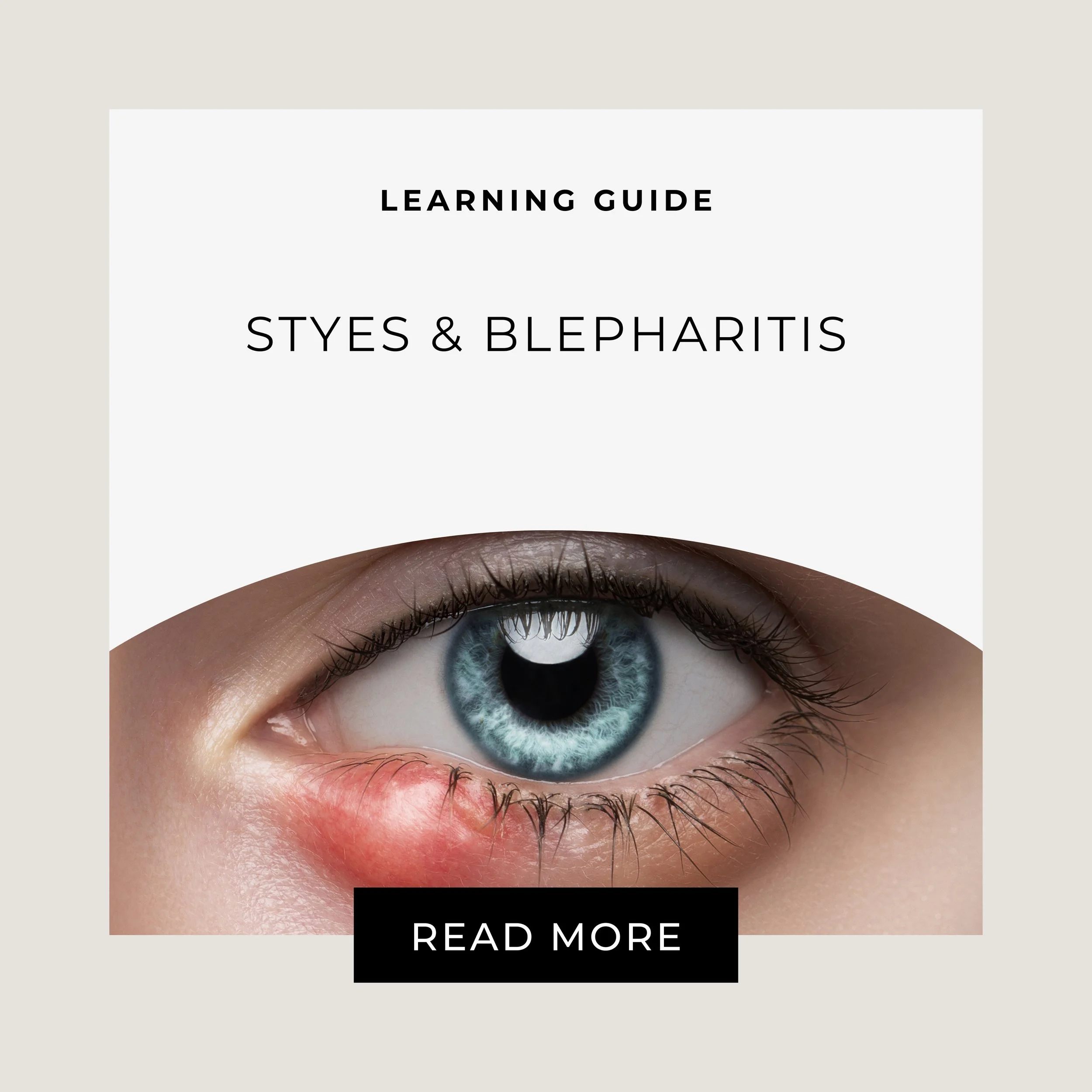 Homeopathic Remedies for Styes &amp; Blepharitis