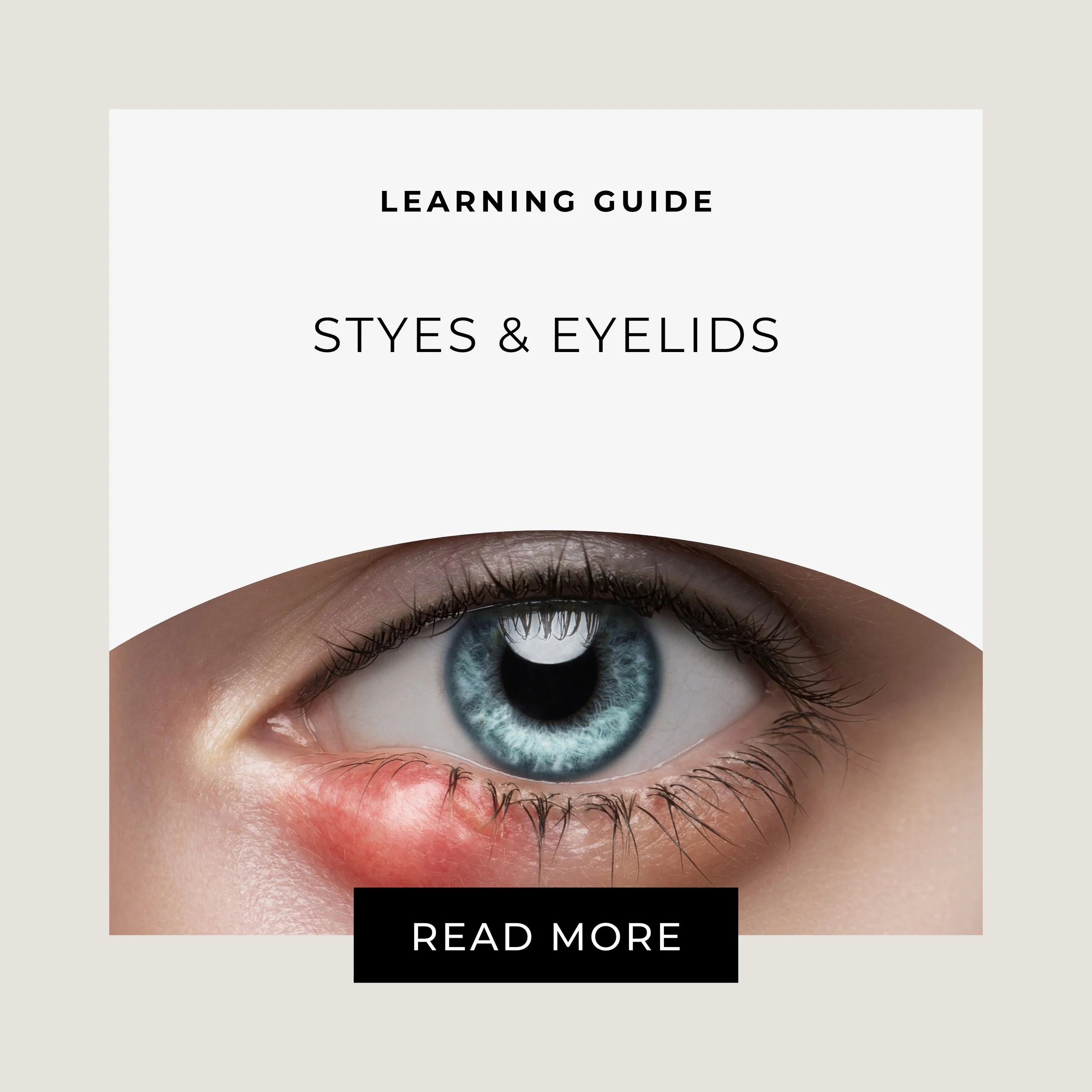 Homeopathic Remedies for Eyelid Symptoms and Styes