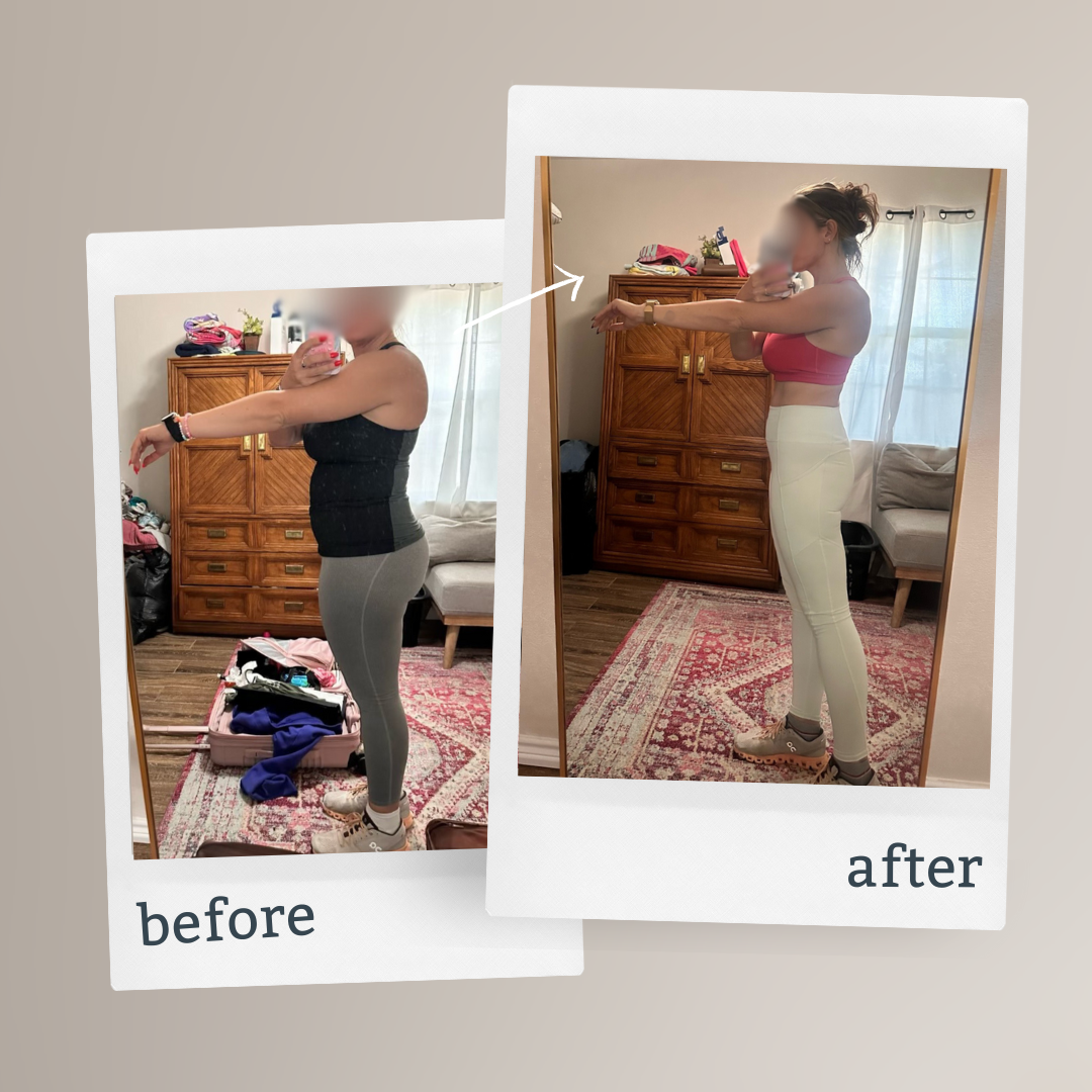 Superior-Female-Before-After-Testimonial-Side-Profile.png