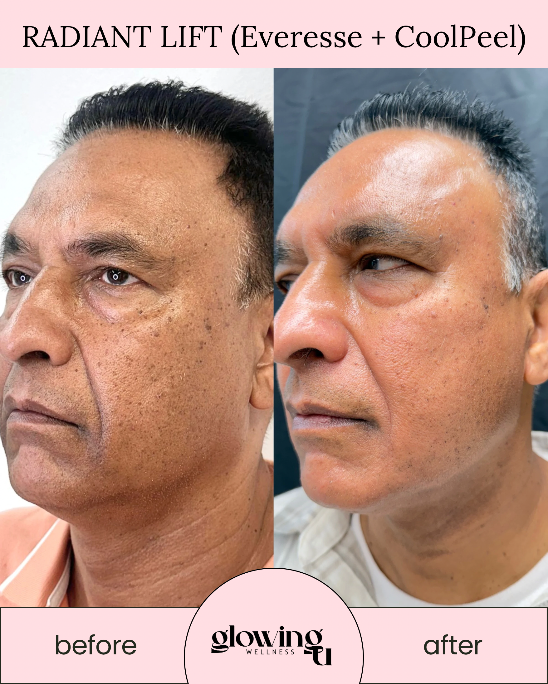 GlowingU Instagram Post - 49.PNG