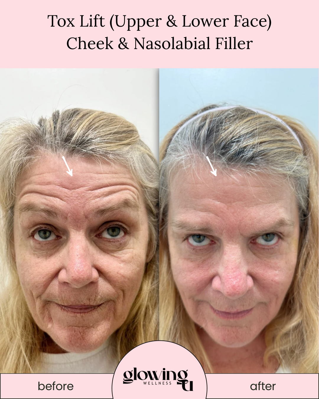 GlowingU Instagram Post - 3.PNG