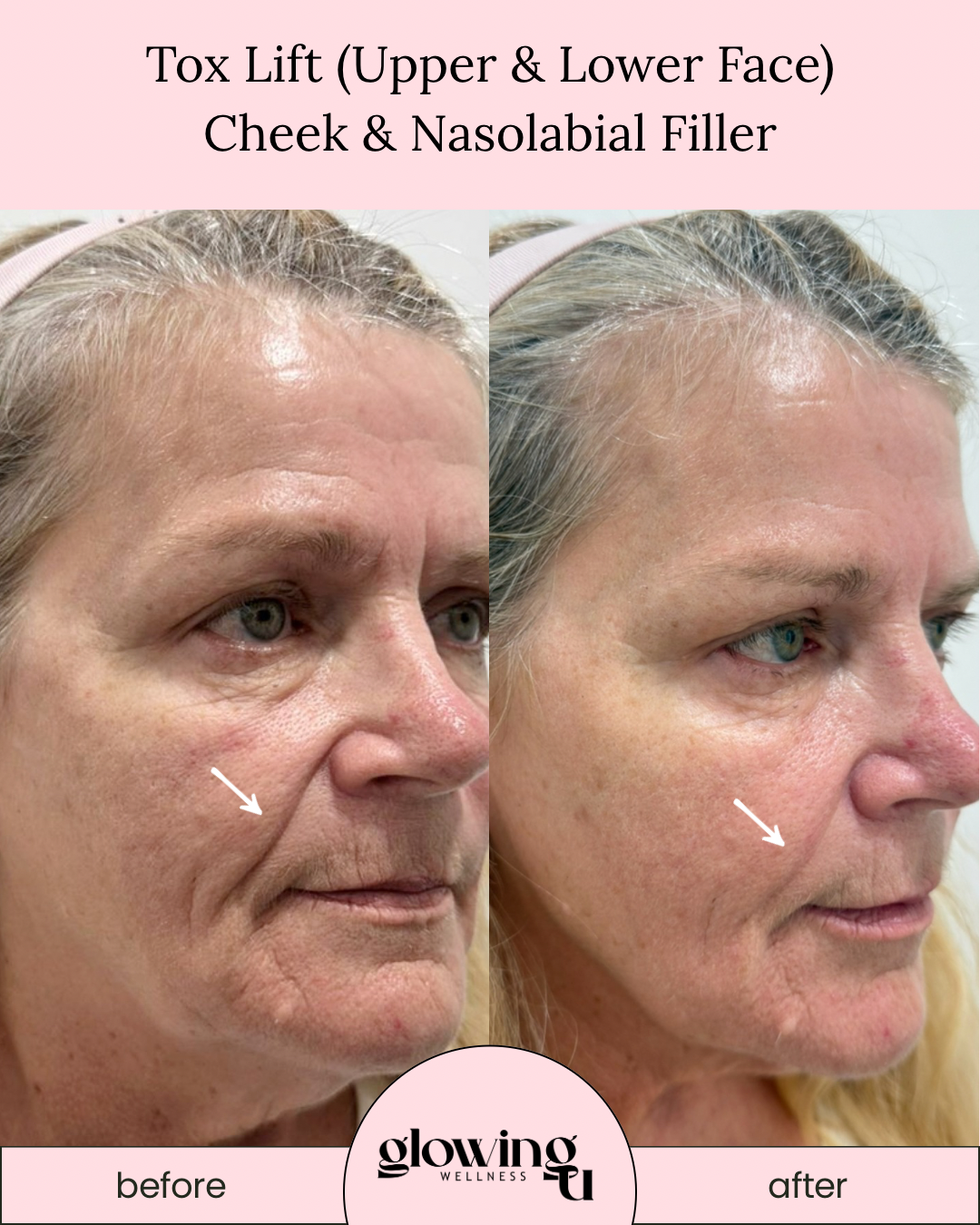 GlowingU Instagram Post - 4.PNG