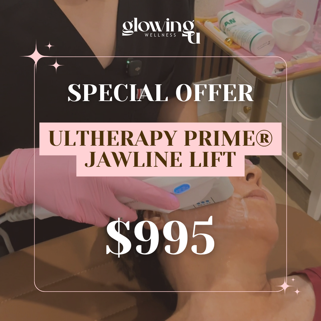 UltherapyPRIME jawline lift at glowing u wellness in torrance.png