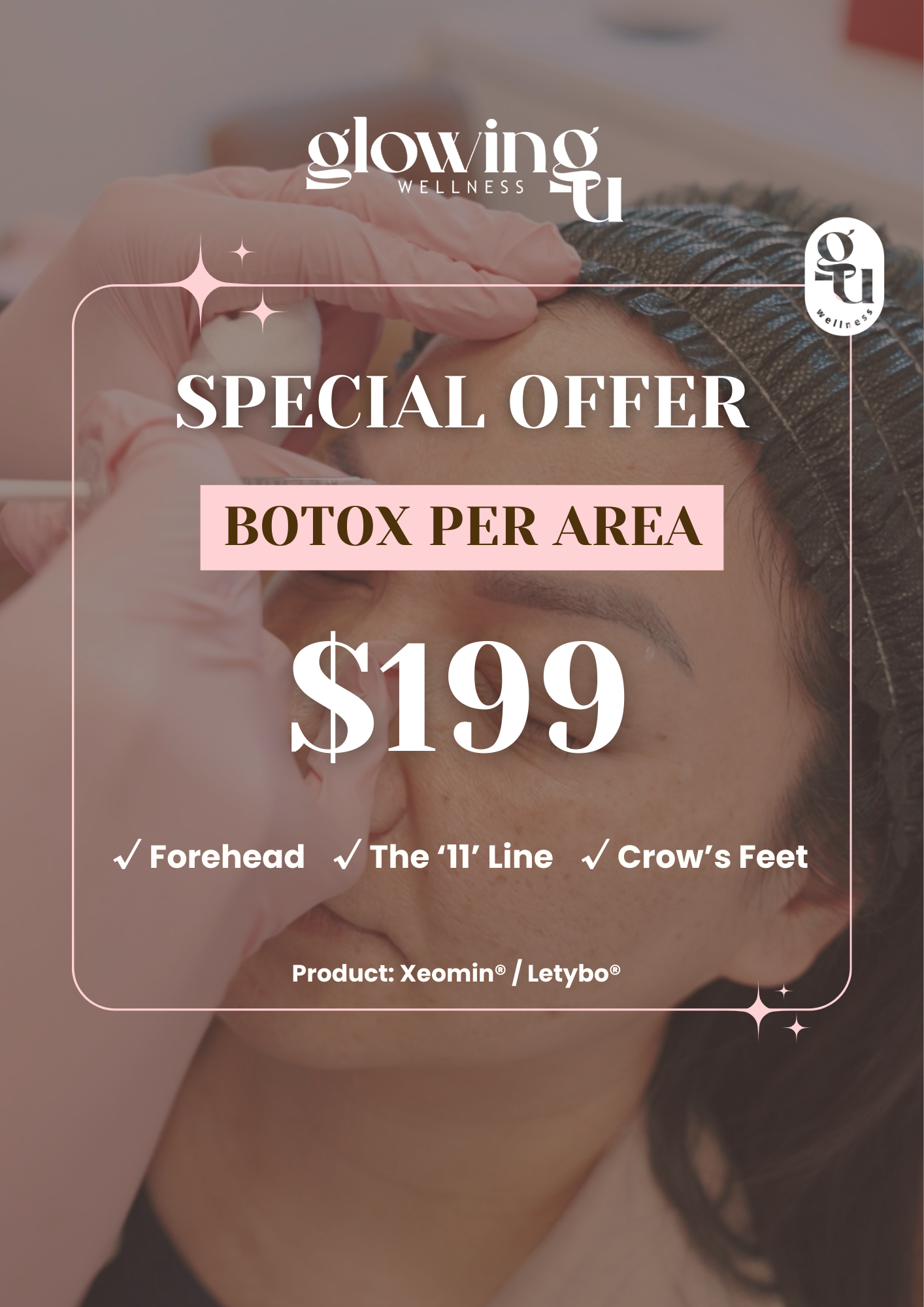 Botox per area promo for $199