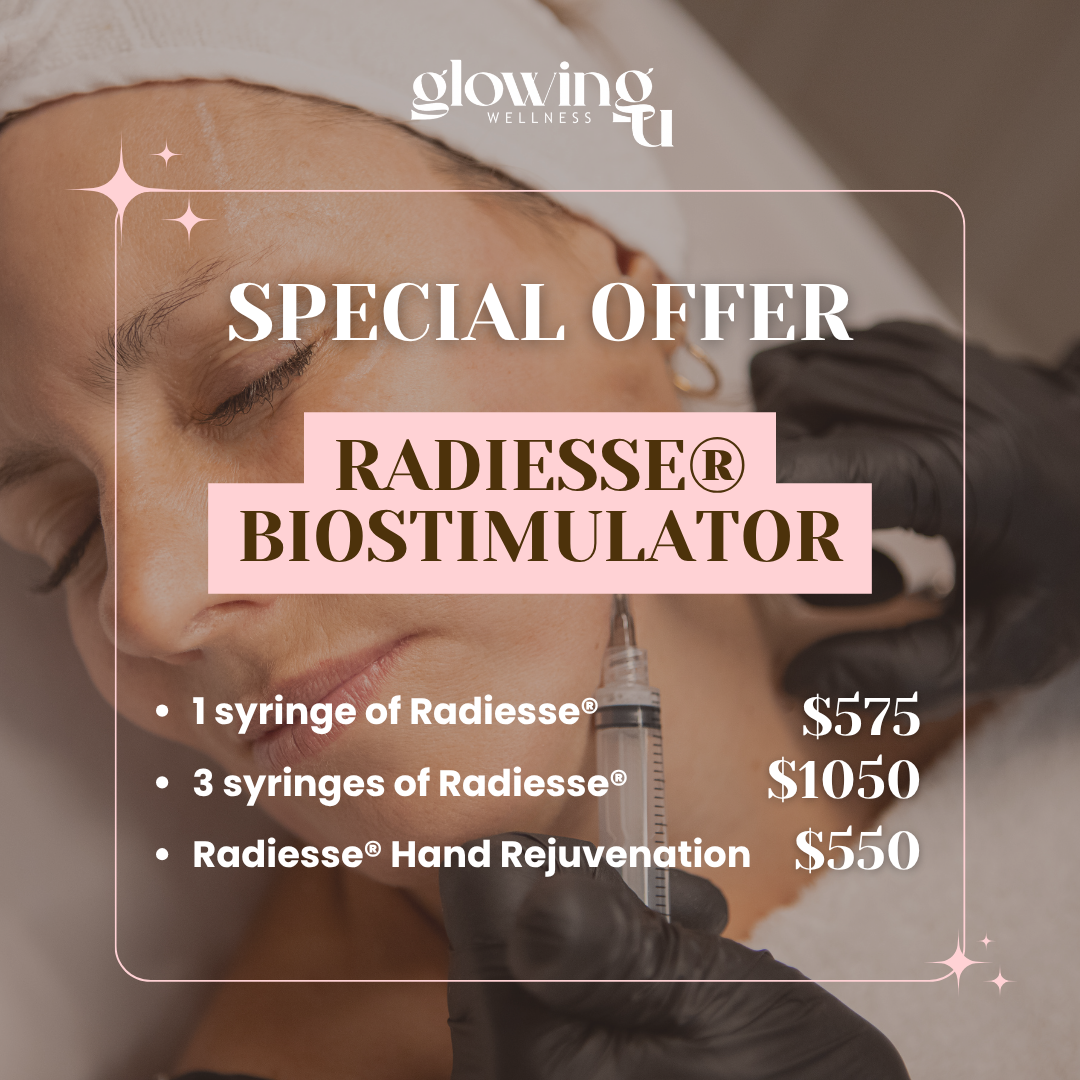 Special: Radiesse® Biostimulator