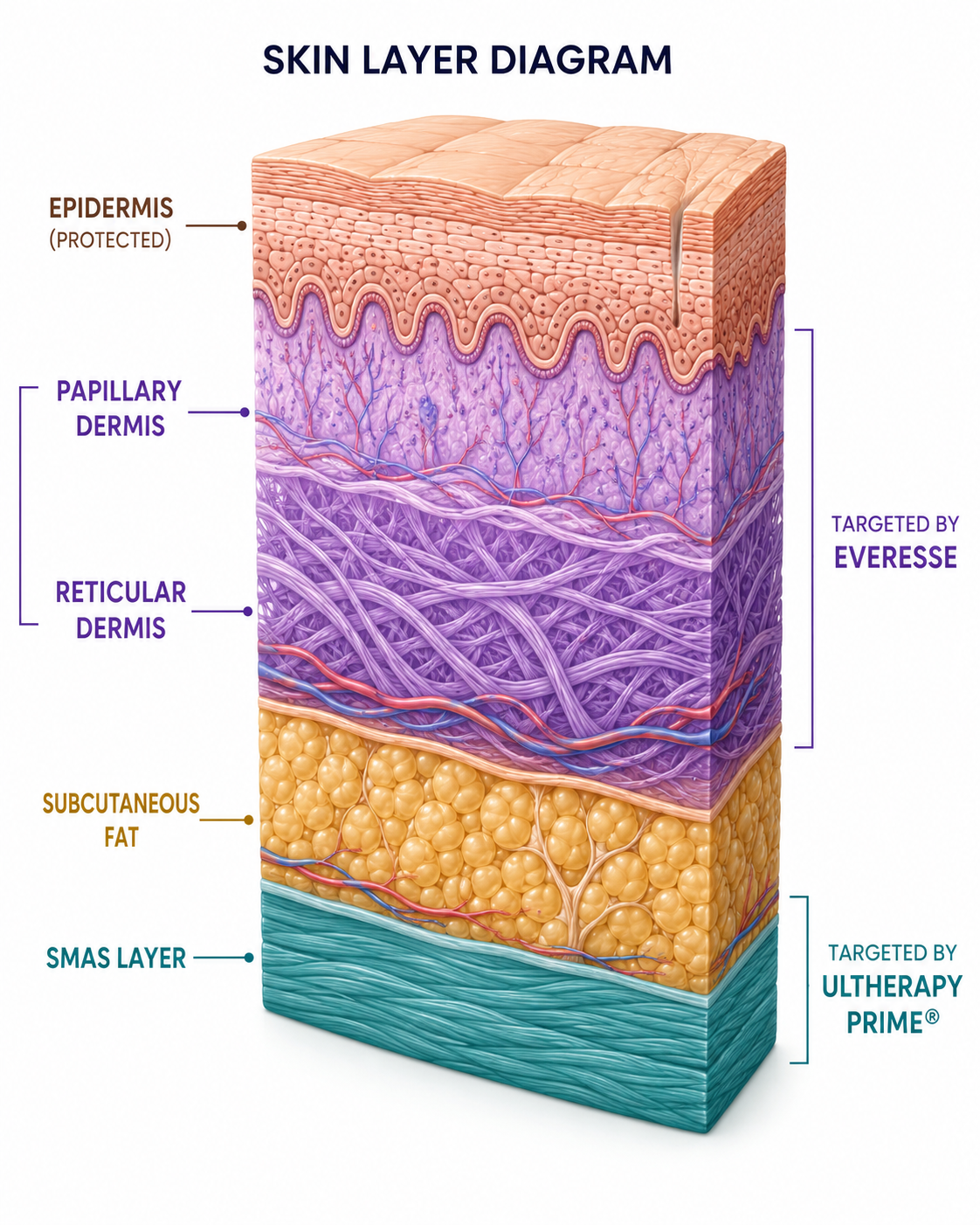 SKIN LAYER DIAGRAM skin diagram here showing: Epidermis (protected) → Papillary Dermis → Reticular Dermis (both targeted by Everesse, shown in purple) → Subcutaneous Fat → SMAS layer (targeted by Ultherapy Prime®, shown in teal).