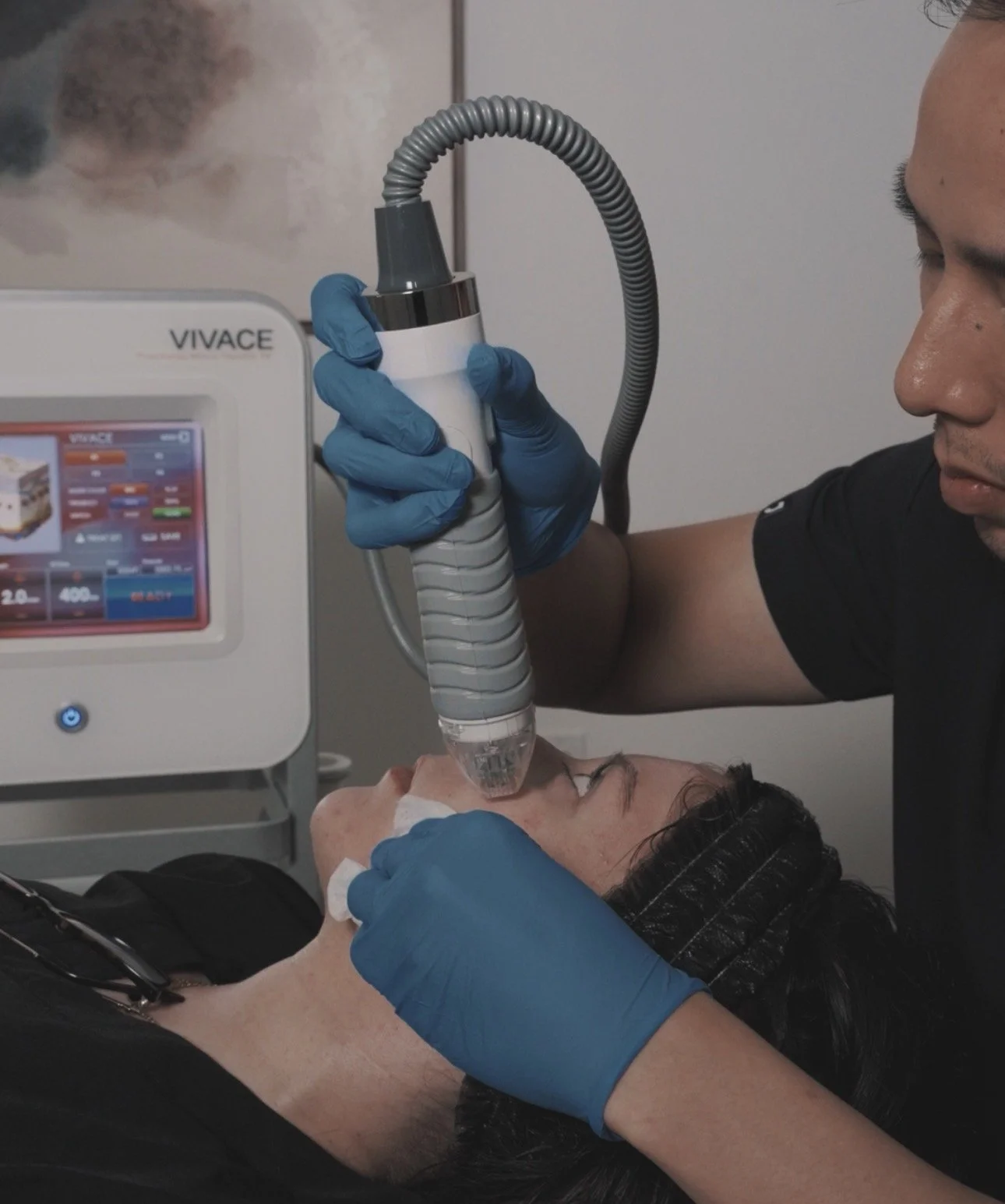 Vivace RF microneedling treatment with red LED light therapy at Glowing U Wellness in Torrance CA 90505