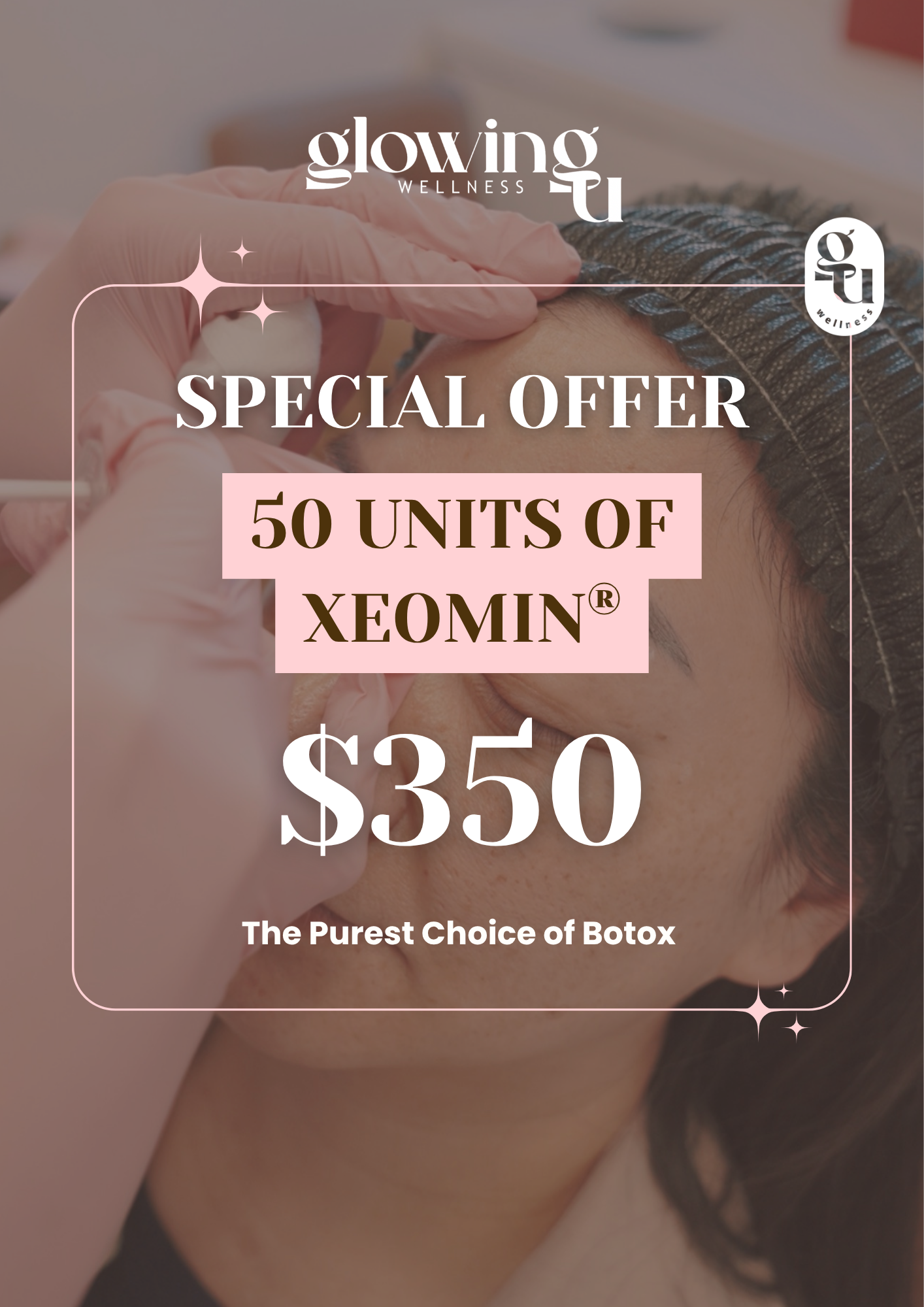 xeomin promo at Glowing U Wellness medspa.png