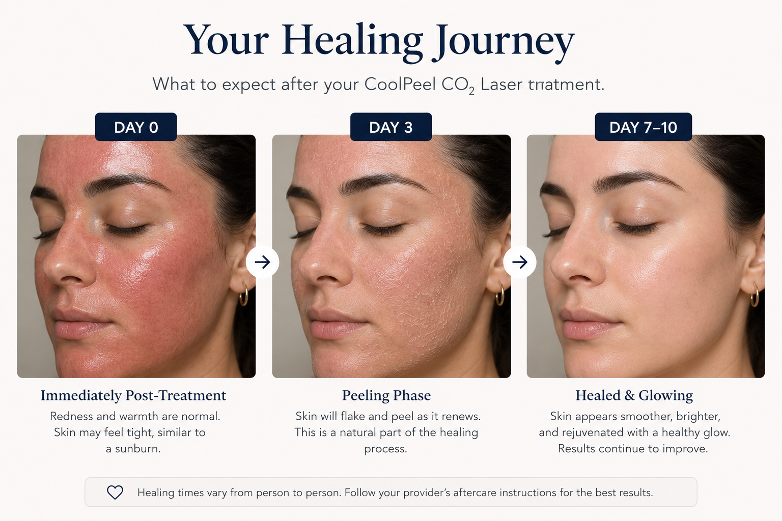 CoolPeel CO2 laser healing timeline at Glowing U Wellness Torrance CA
