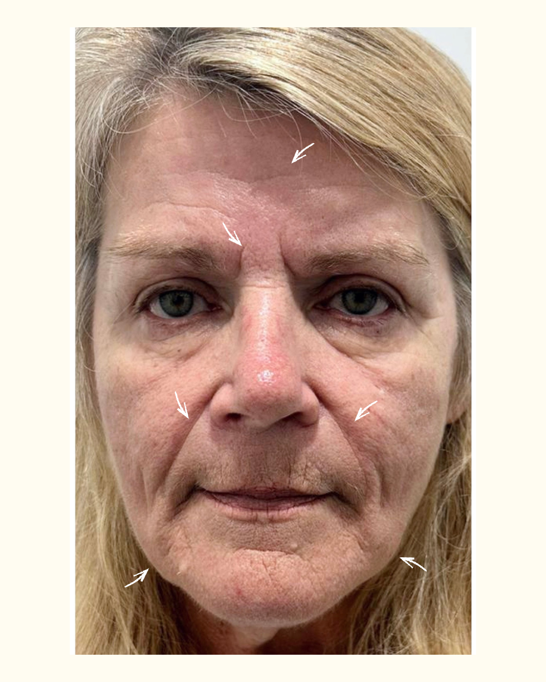 glowing u wellness - charlene-before.png