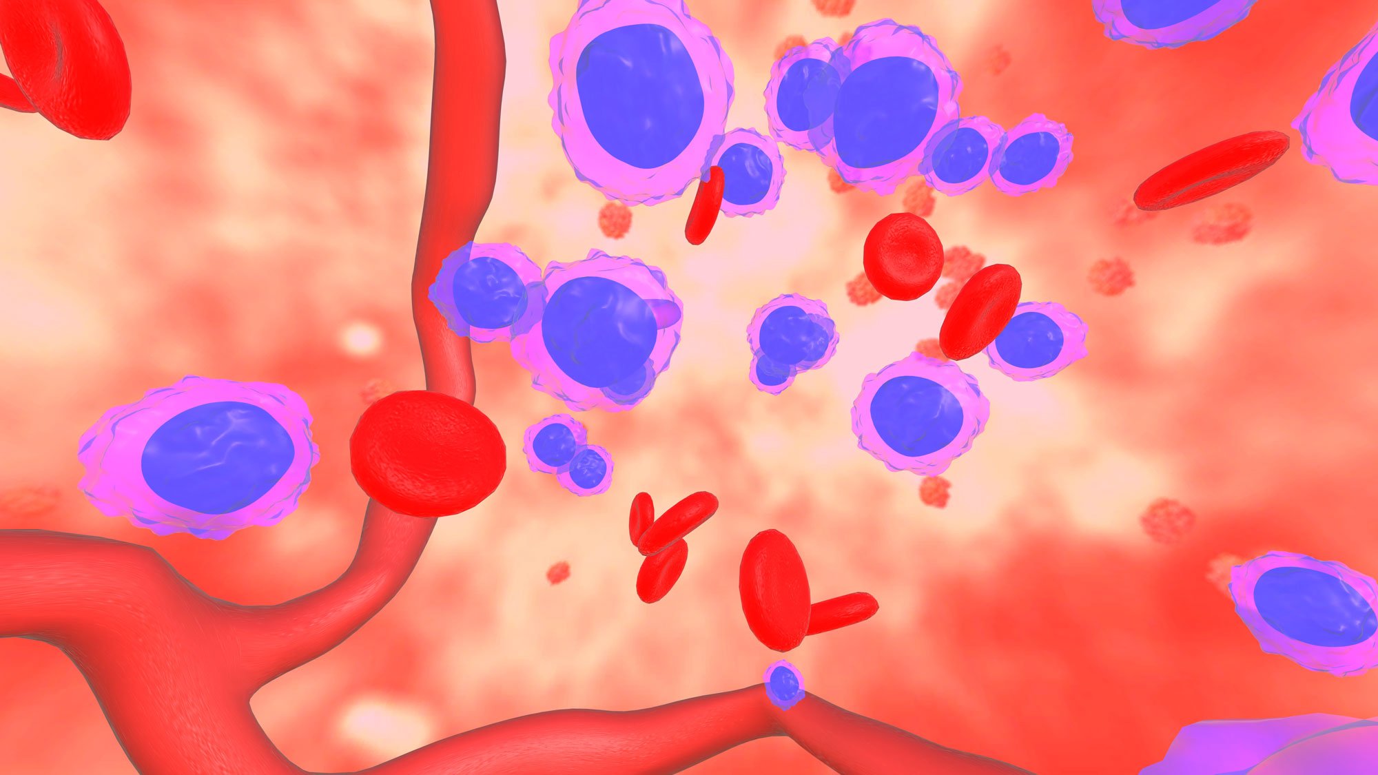 Bone marrow environment in the CRISPR & Sickle Cell experience