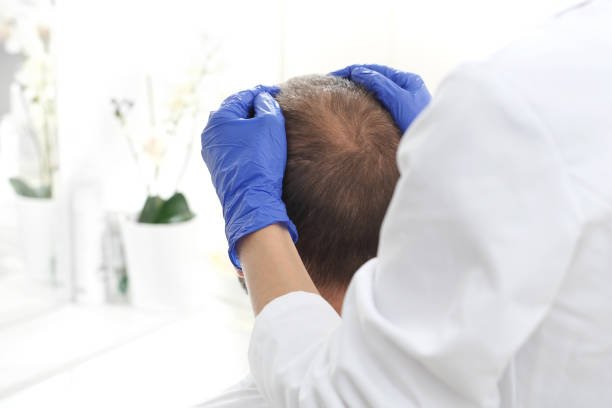 Hair Restoration