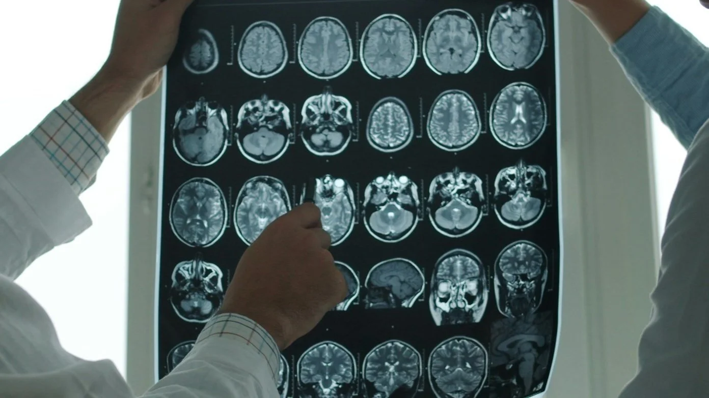 How does a stroke affect mental capacity?