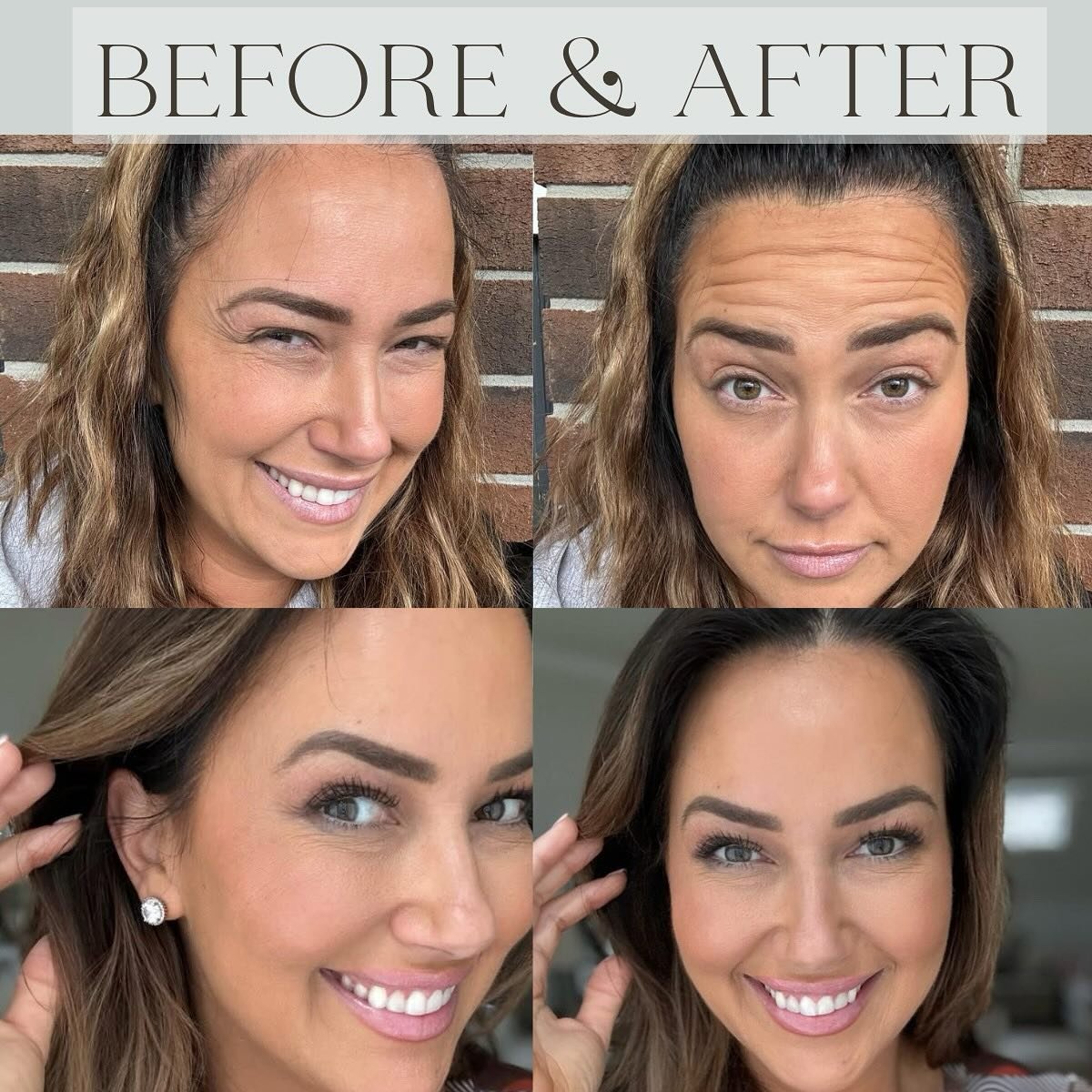 A subtle refresh for a natural glow 😍💉