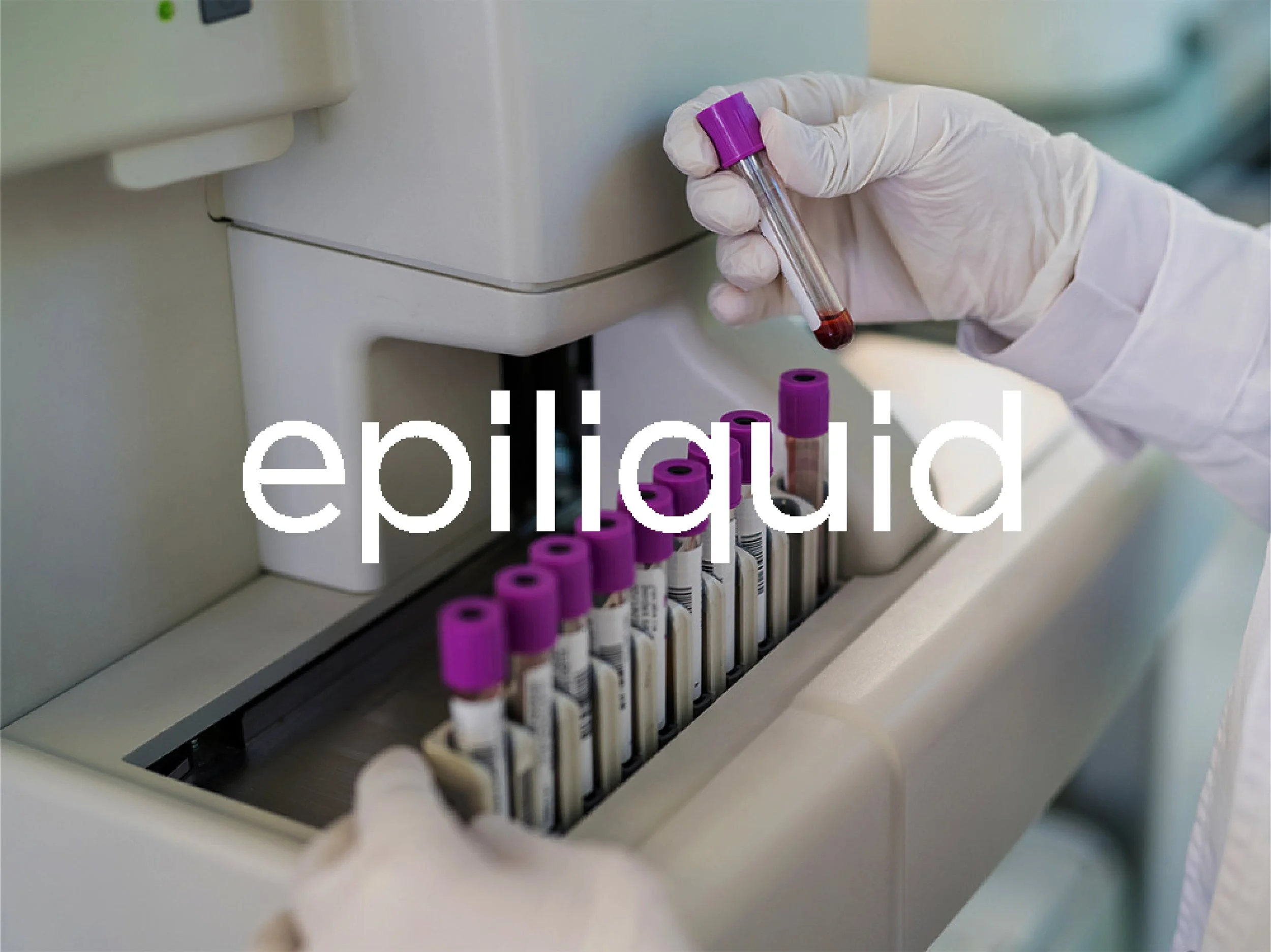 Epiliquid Cover Image