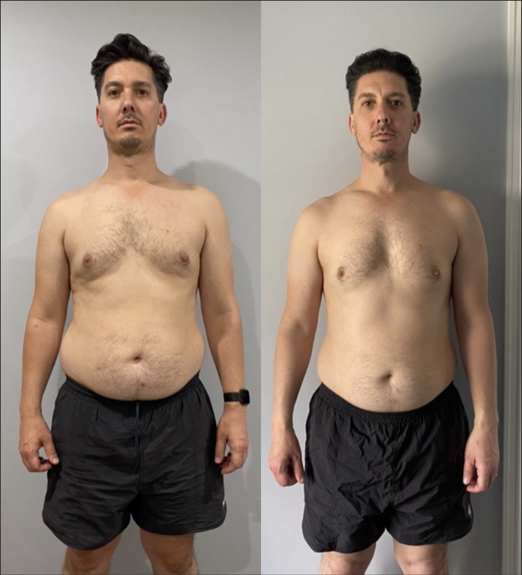Guy - 10kgs.png
