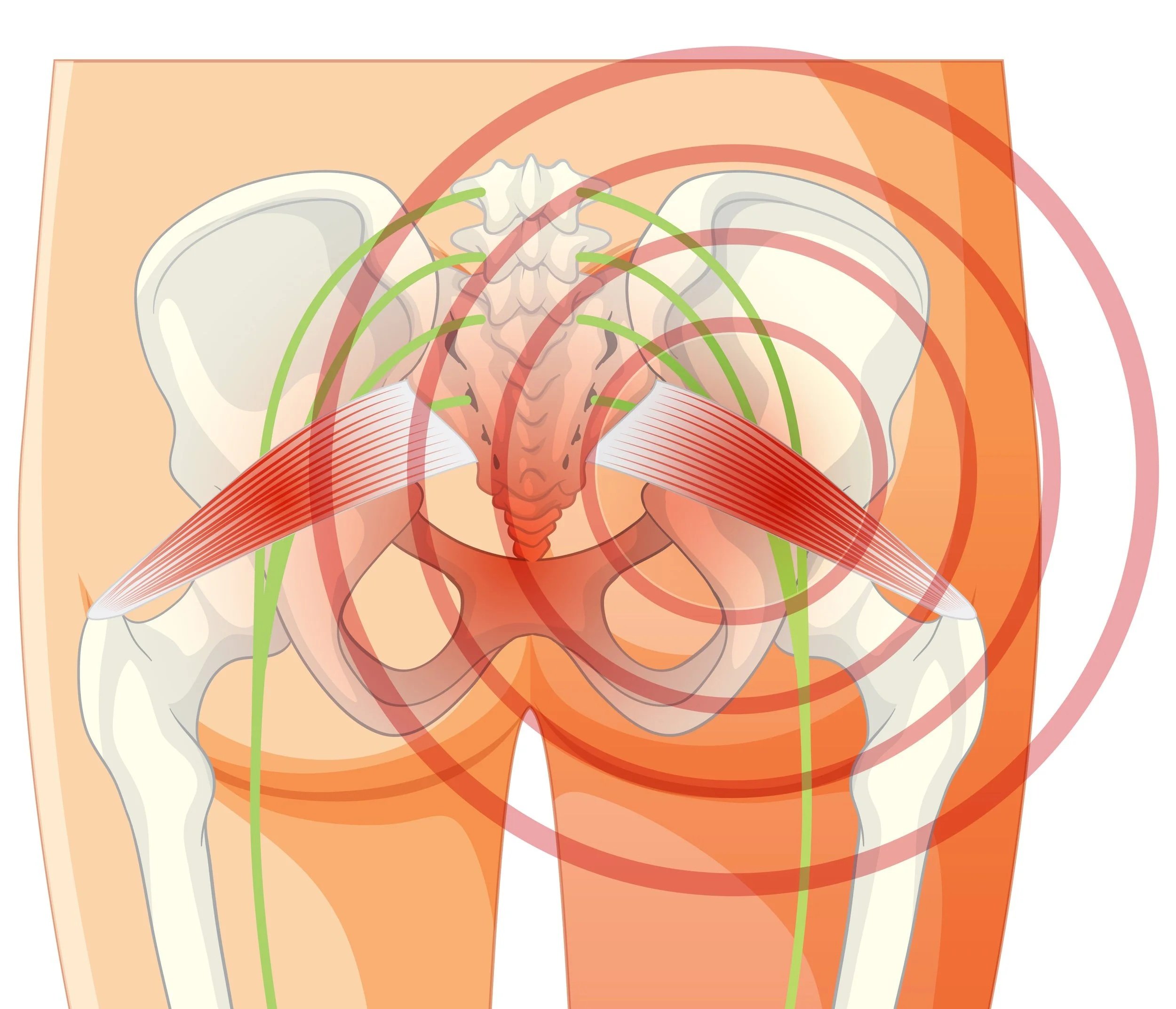 That Deep Hip and Glute Pain That Won't Go Away? It Might Be Piriformis Syndrome — And Acupuncture Can Fix It.