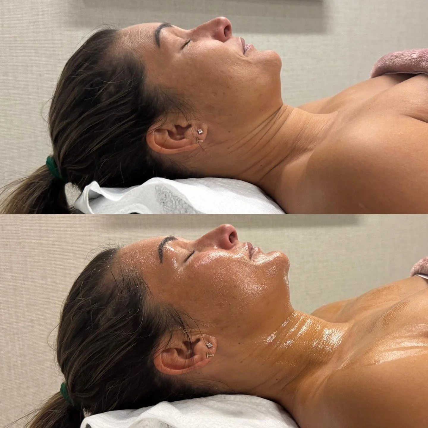The results speak for themselves. 👏🏼
Facial lymphatic massage helps reduce fluid retention, ease puffiness, and support circulation for a firmer, more defined look.

Many clients also notice their skin feels fresher and brighter, with less tension 