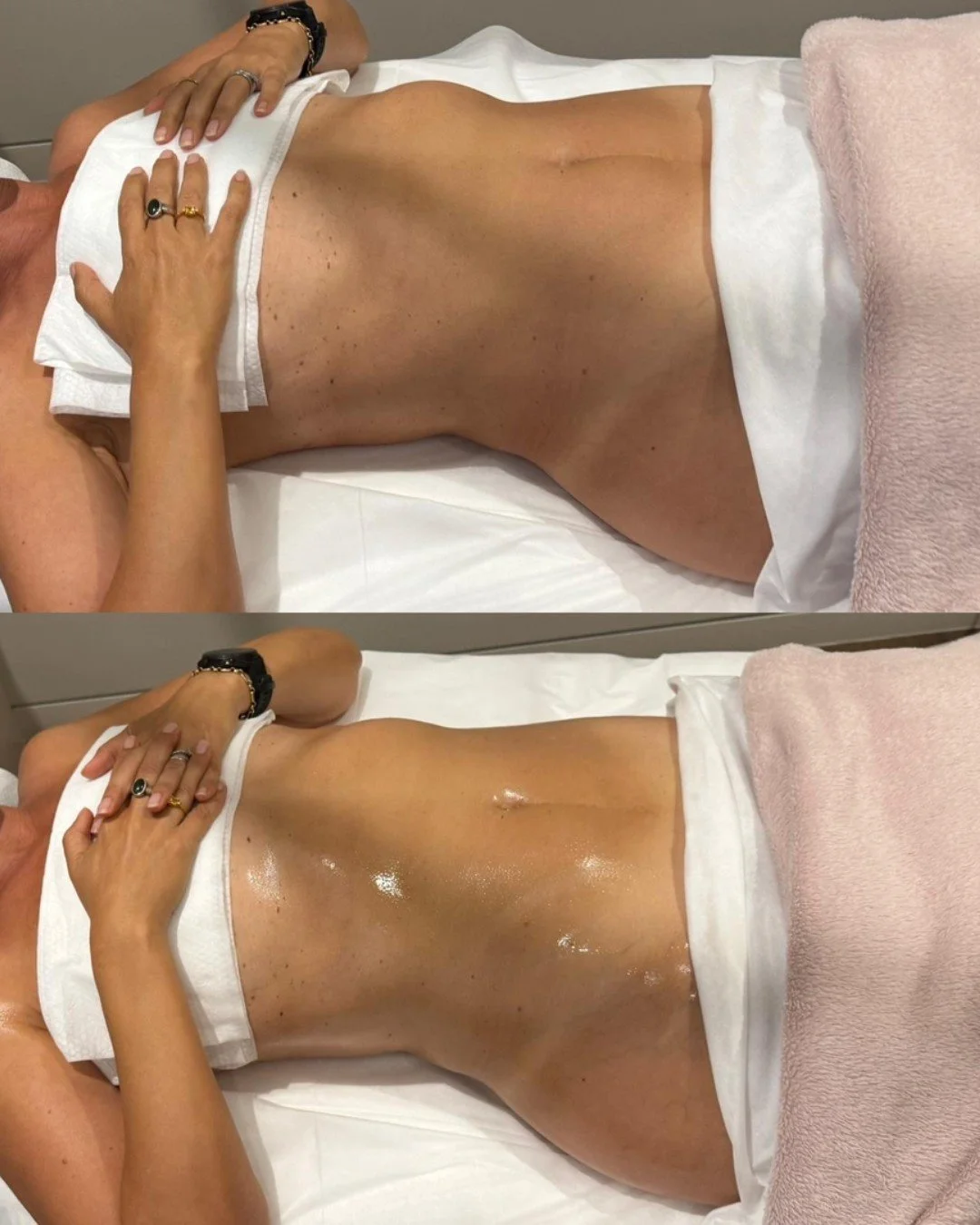 Before and after images often reflect changes in how fluid moves through the body, not just how it looks.

Lymphatic massage works by encouraging lymphatic flow, which helps the body manage fluid more efficiently. When this system starts moving bette