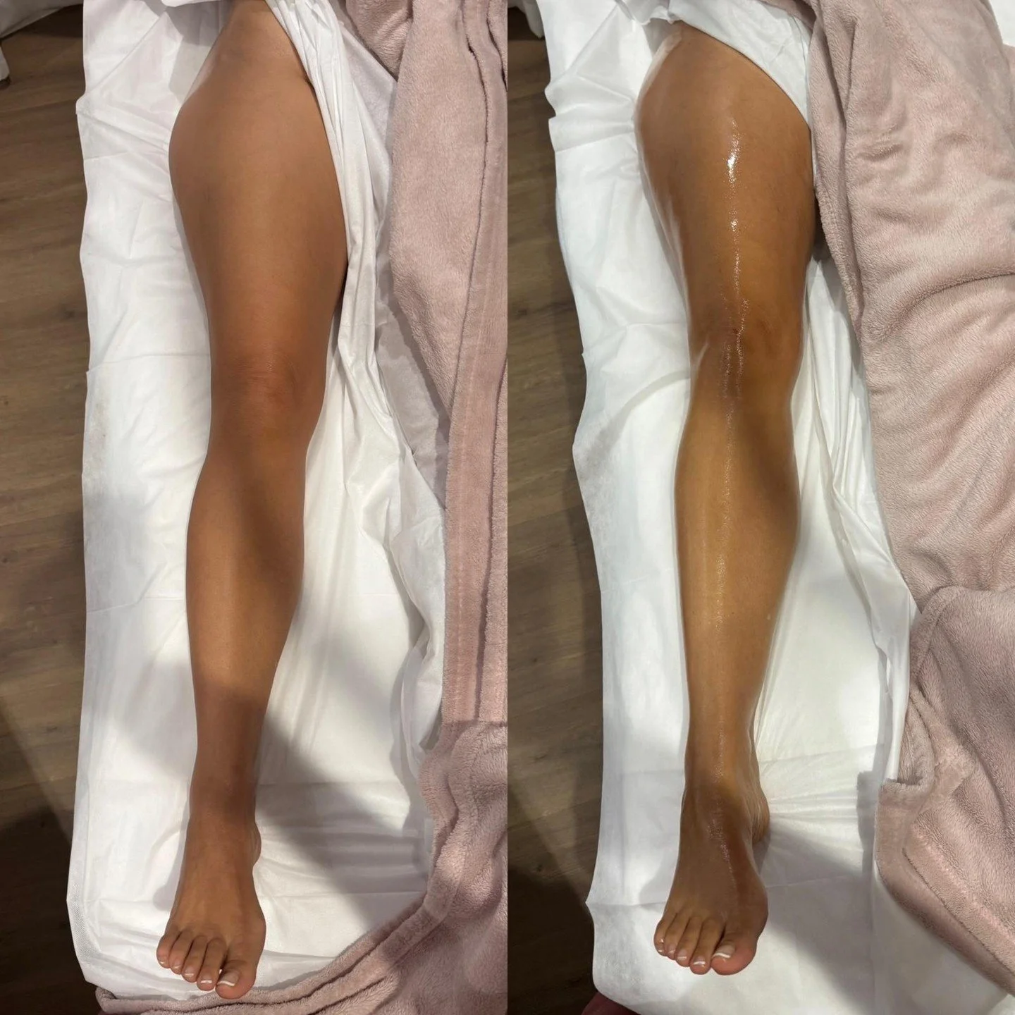 Before and after images are not about comparison.
They reflect how fluid can shift when pathways begin moving more efficiently.

Common changes may include:
&bull; Reduced heaviness through the calves
&bull; Less visible density around ankles
&bull; 