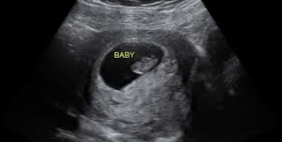 When Does Life Begin?