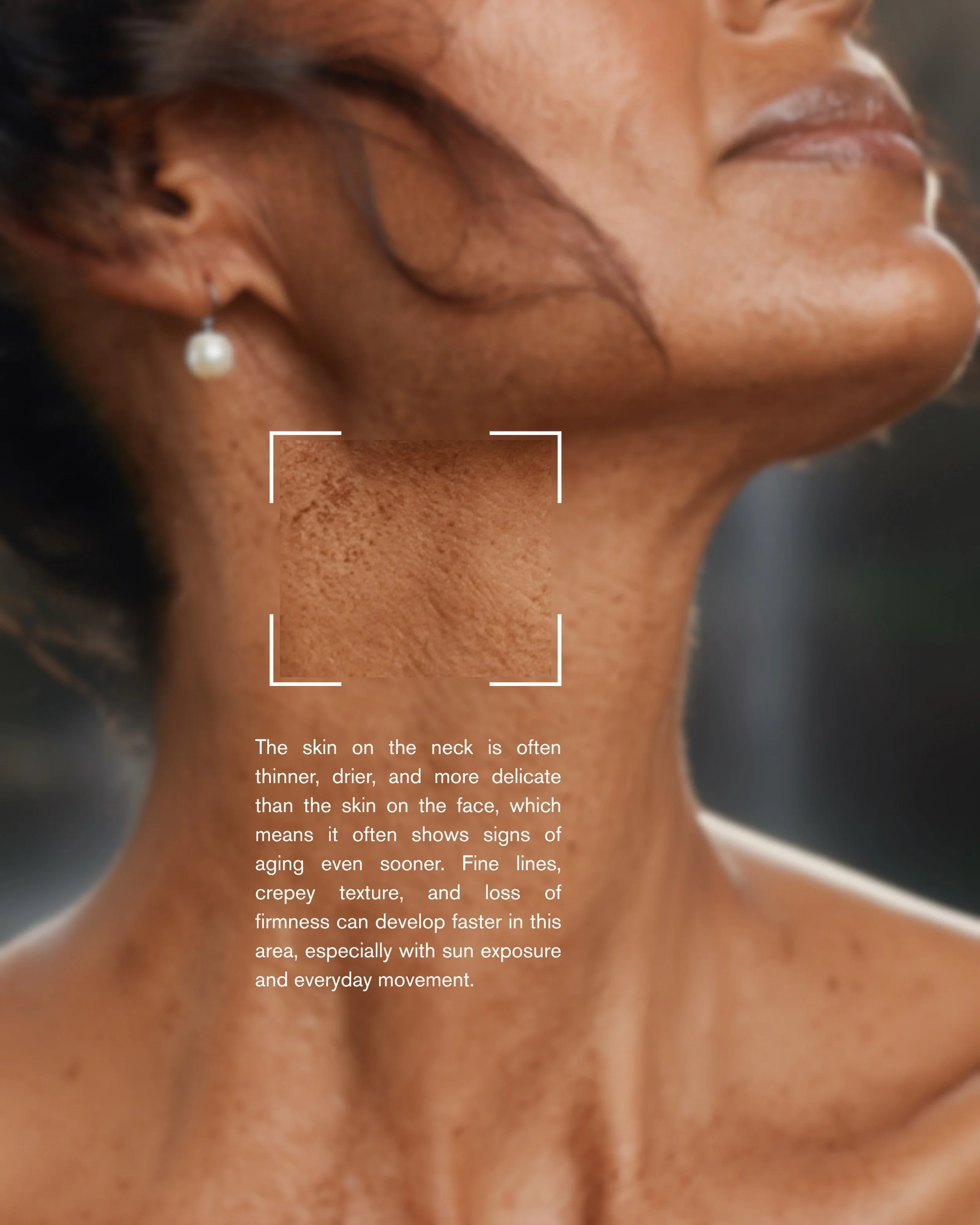 Microneedling for the face gets all the attention, but the neck deserves just as much care.

The skin on the neck is thinner, drier, and more delicate than the skin on the face, which means signs of aging often appear here even sooner.
Fine lines, cr