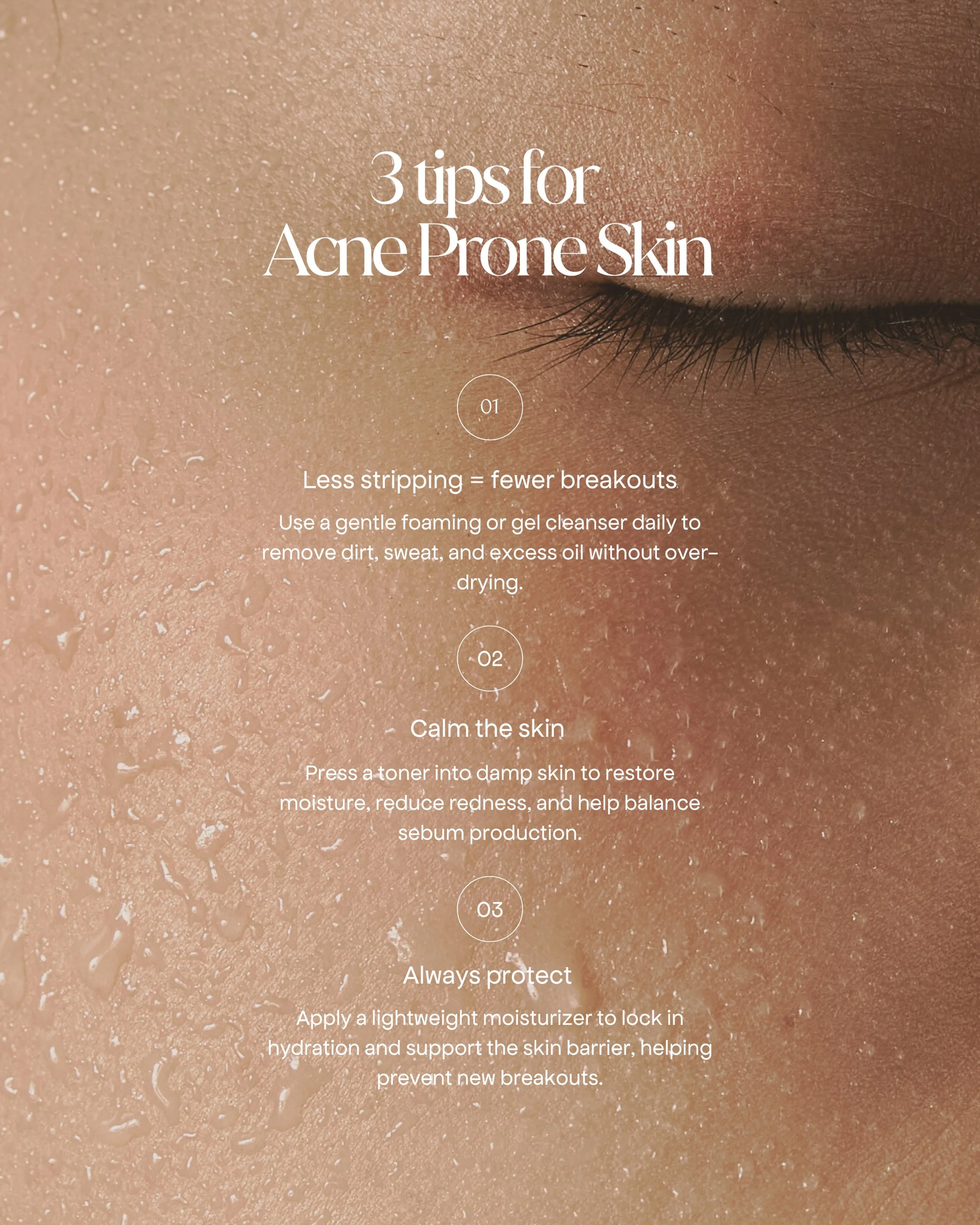 Acne-prone skin doesn&rsquo;t always need harsher products often, it needs better balance.

One of the biggest misconceptions about breakouts is that drying out the skin will &ldquo;fix&rdquo; acne. In reality, over-stripping the skin barrier can lea