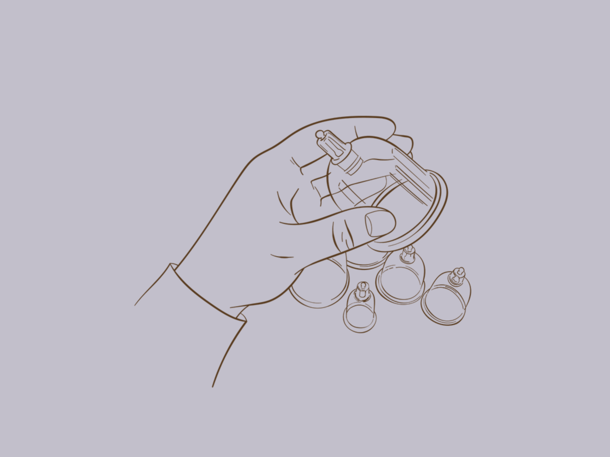 A hand holding a glass cup for therapeutic cupping.