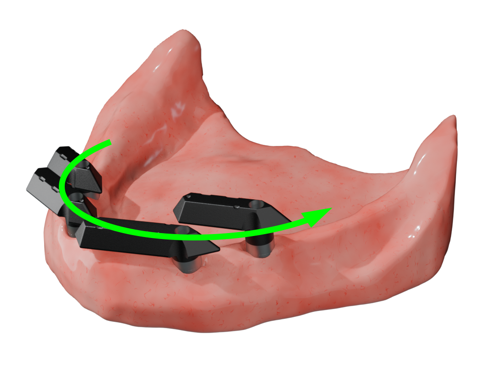 Lower Scan Gauge Scan (L to R)
