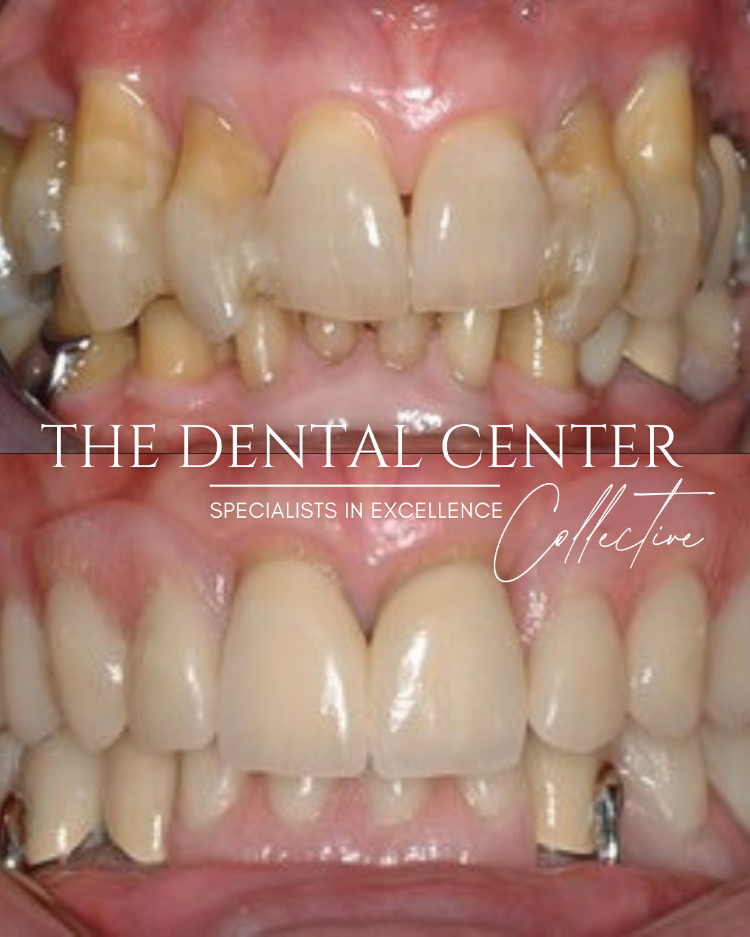 The Dental Center (73).png