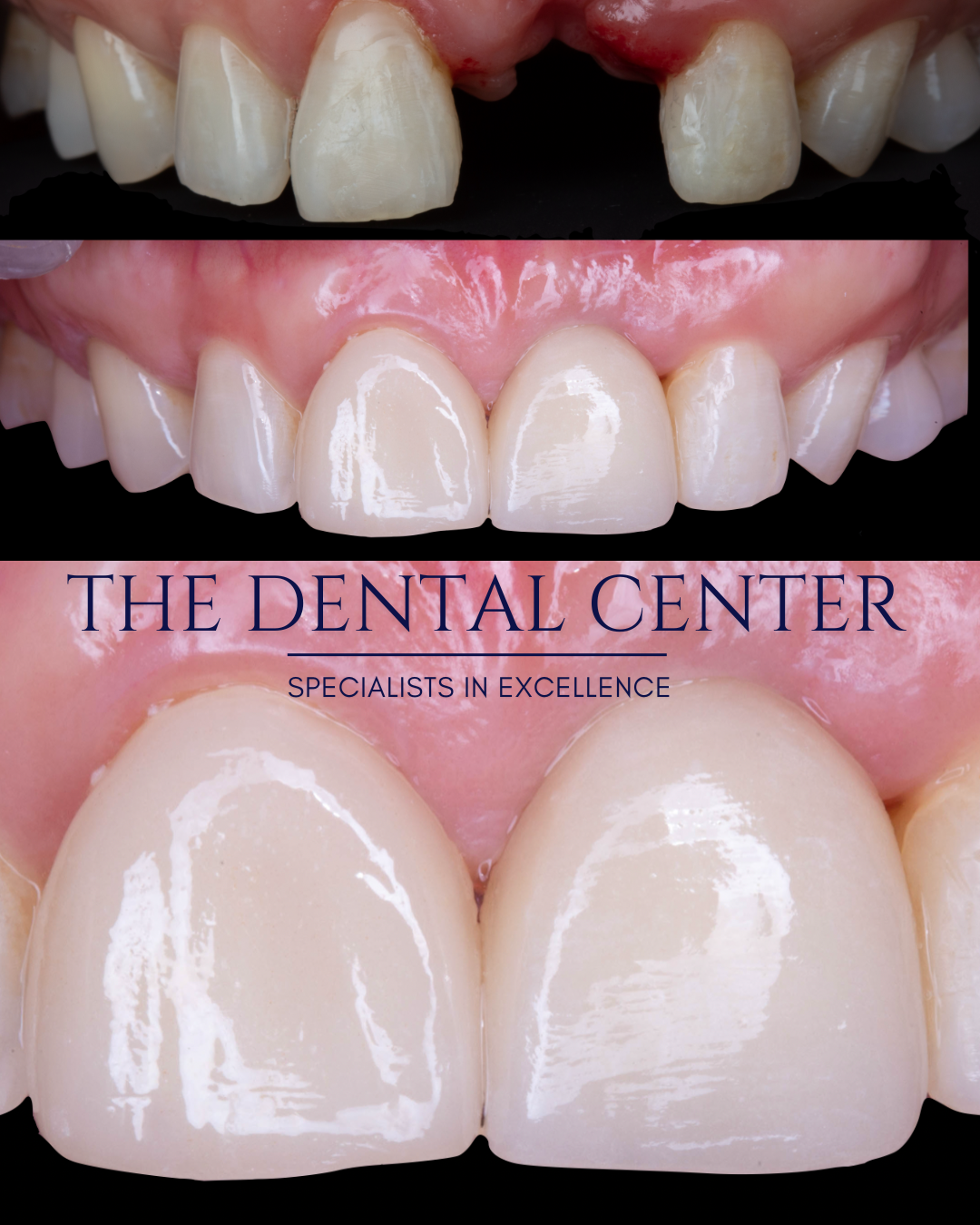 The Dental Center (39).png