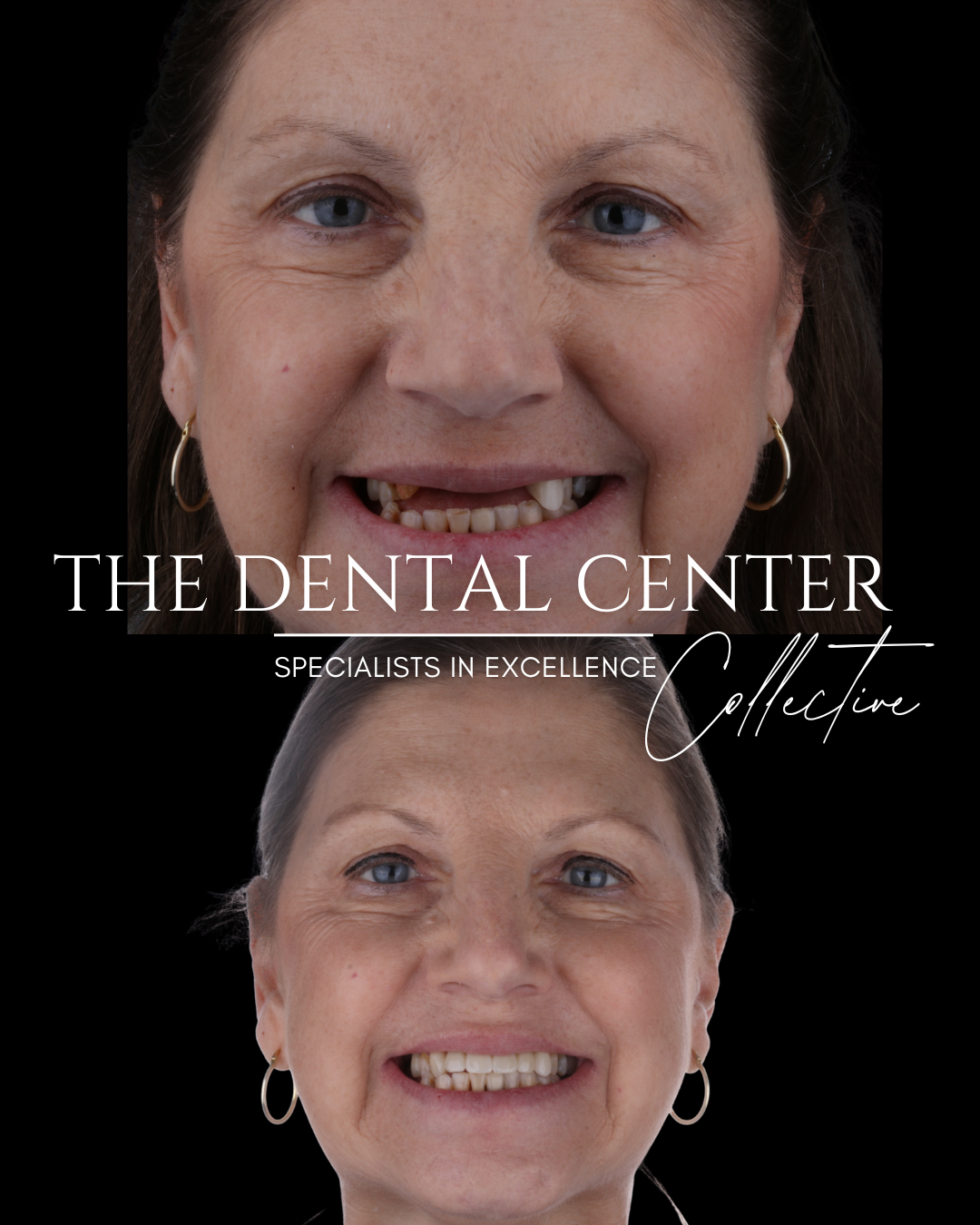 The Dental Center (59).png